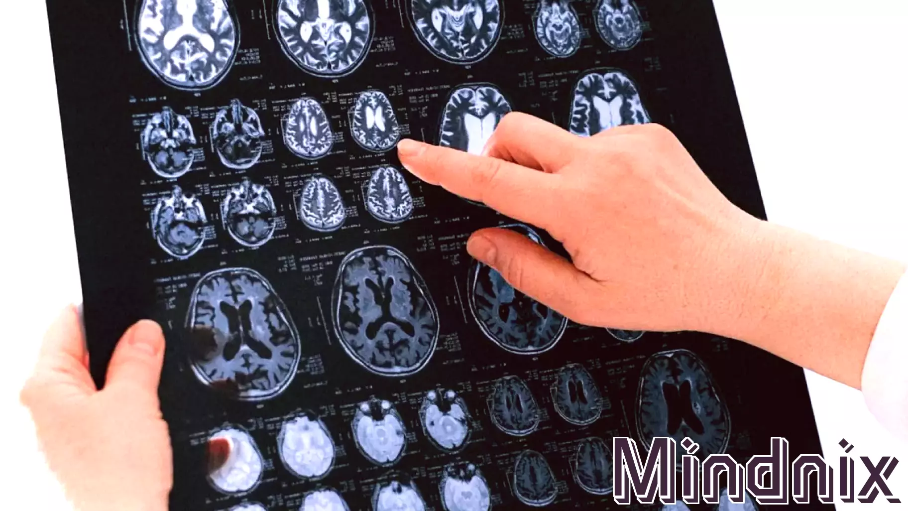 The Brain Beneath the Label