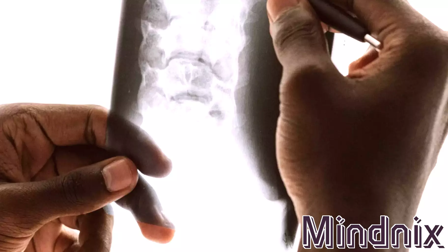 The Glenn Gould of Radiology