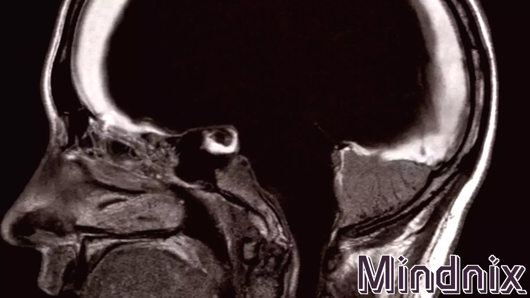 The Surprising Reality of Brain Functionality