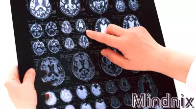 The Brain Beneath the Label